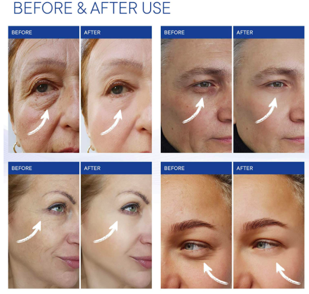 Instant Eye Lift Gel(Pack of 2)